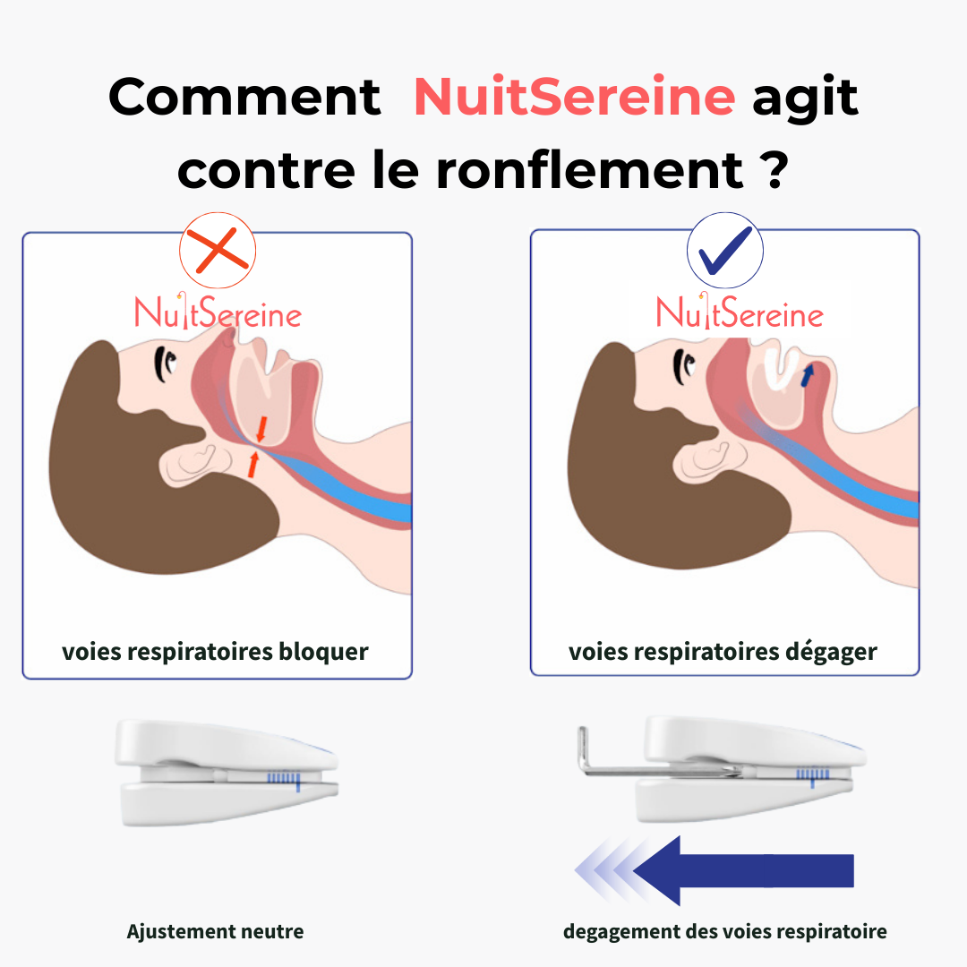 Solution anti-ronflement NuitSereine