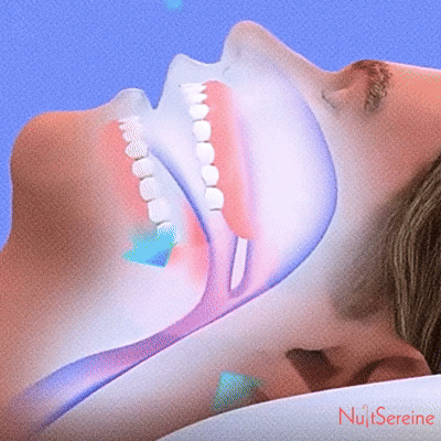 Solution anti-ronflement NuitSereine