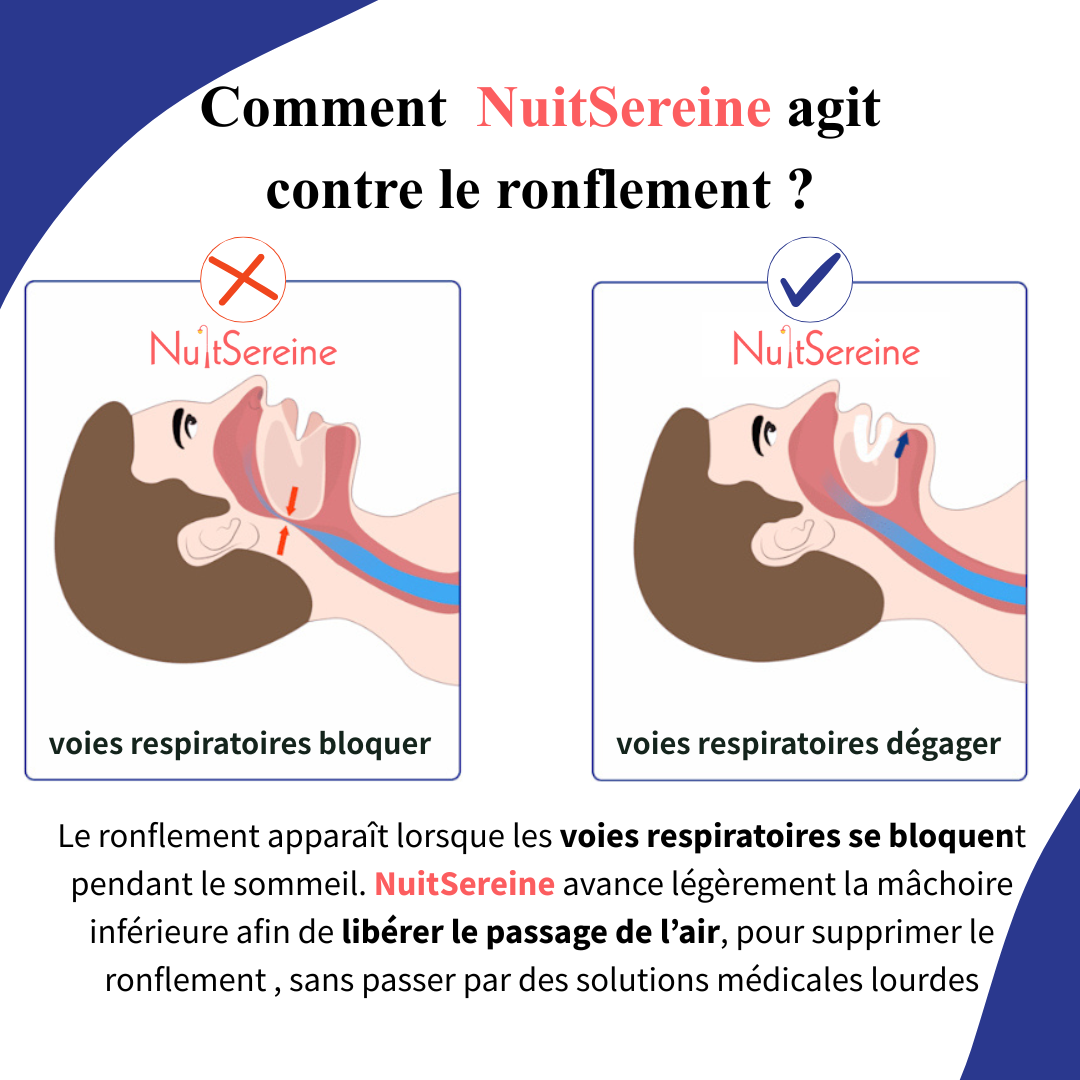 Solution anti-ronflement NuitSereine